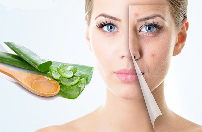 Cần ngừng cách làm mặt nạ nha đam đang sử dụng khi da bỏng rát, sưng hoặc nổi mụn nước
