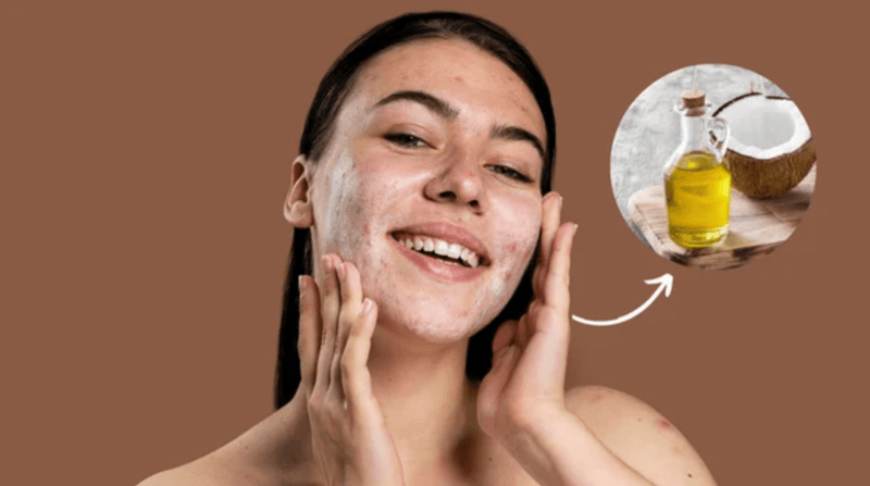 Dầu dừa chỉ nên là bước dưỡng ẩm bổ trợ trong một quy trình chăm sóc da toàn diện.