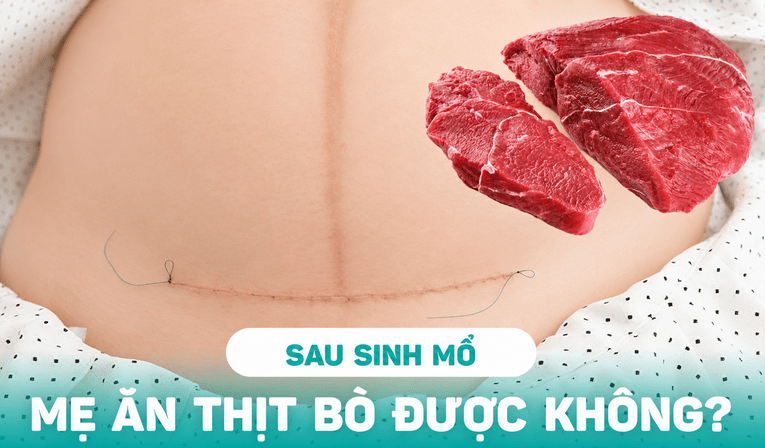 Mẹ sau sinh mổ nhìn chung có thể ăn thịt bò nếu không có chống chỉ định riêng từ bác sĩ