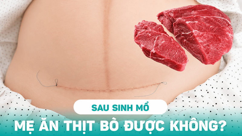 Mẹ sau sinh mổ nhìn chung có thể ăn thịt bò nếu không có chống chỉ định riêng từ bác sĩ