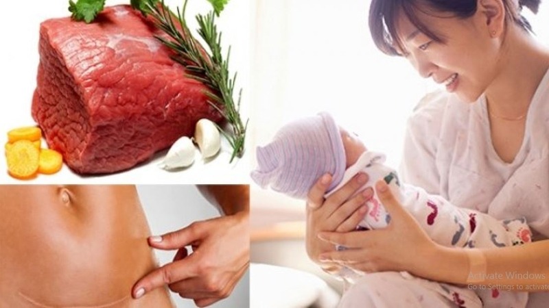 Một số mẹ sau sinh mổ có bệnh lý nền hoặc vấn đề tiêu hóa cần thận trọng khi ăn thịt bò 