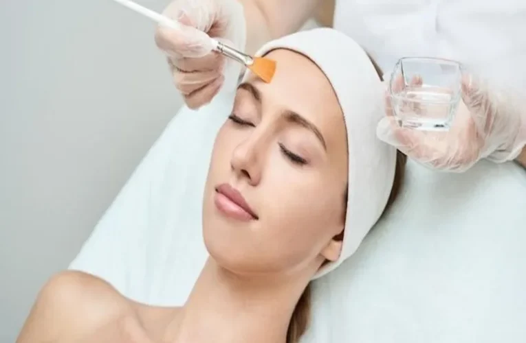 Peel da bao lâu thì rửa mặt? – Hướng dẫn chăm sóc da đúng cách