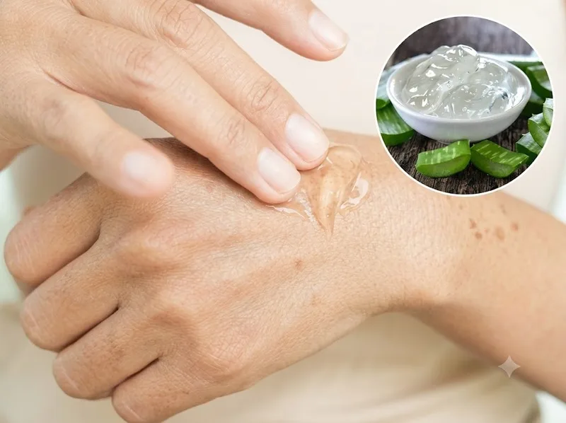 Nha đam có khả năng làm dịu, dưỡng ẩm cho da.