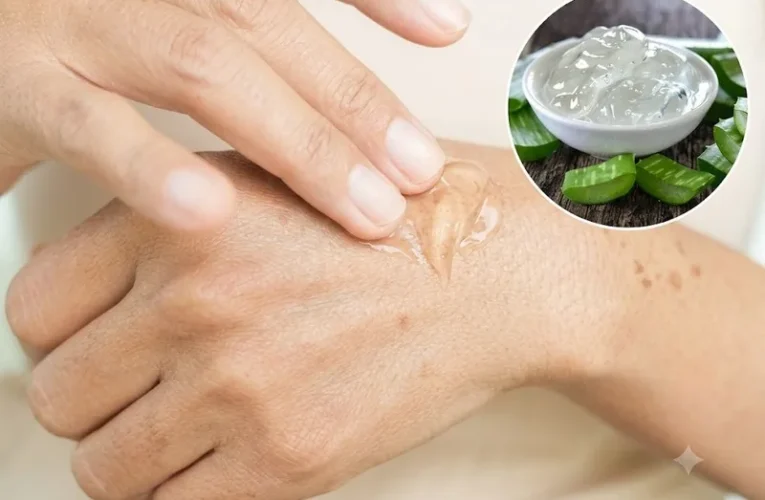 Cách trị đồi mồi ở tay tại nhà: Bí quyết an toàn dễ áp dụng